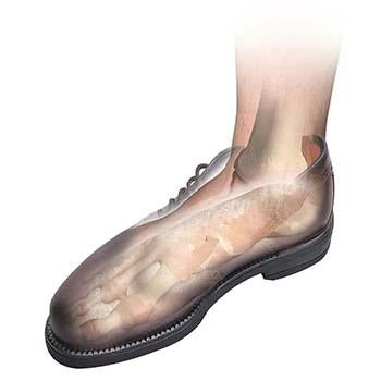 Load image into Gallery viewer, Hapad Comf-Orthotic Extra Cushioning Replacement Insoles
