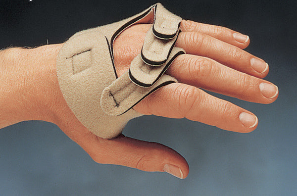 Load image into Gallery viewer, Norco Soft MP Ulnar Drift Support
