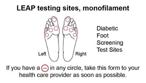 Load image into Gallery viewer, Baseline Disposable Monofilaments - ADA and LEAP Programs
