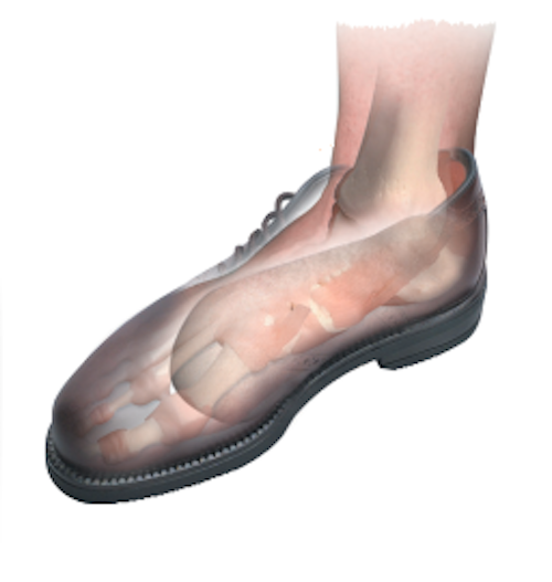 Load image into Gallery viewer, Hapad Comf-Orthotic 3/4 Length Insoles
