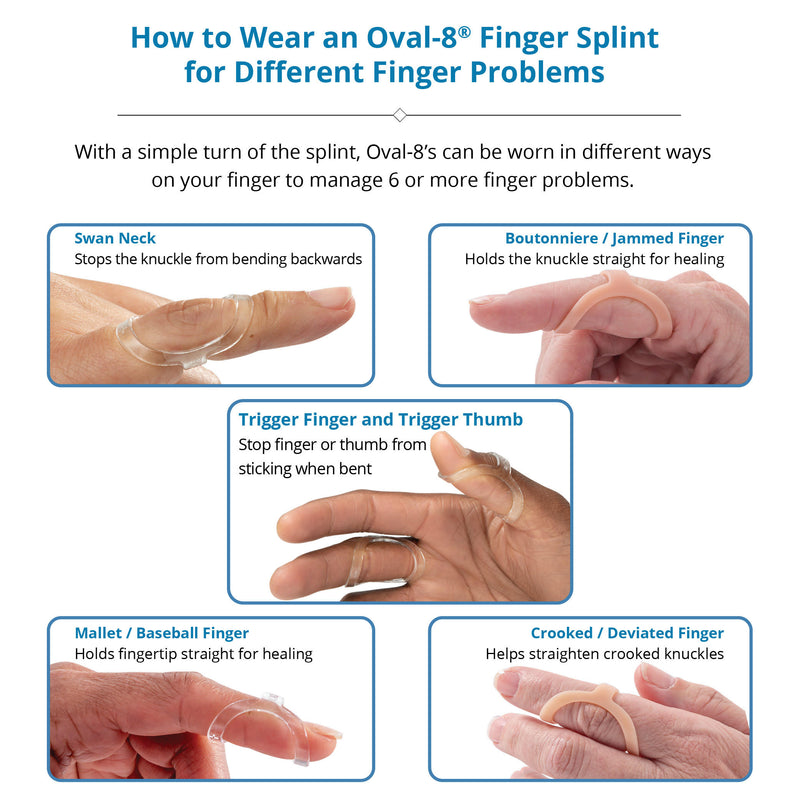 Load image into Gallery viewer, Oval-8® Finger Splints
