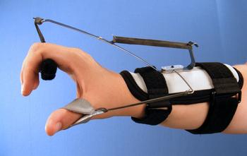 Load image into Gallery viewer, Bunnell Thomas Suspension Orthosis
