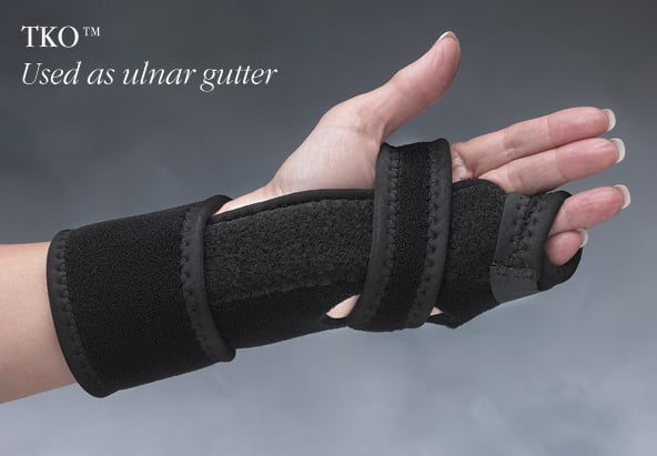 Load image into Gallery viewer, Hely &amp; Weber TKO™ Knuckle Orthosis
