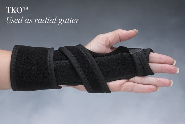 Load image into Gallery viewer, Hely &amp; Weber TKO™ Knuckle Orthosis
