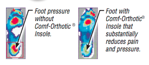 Load image into Gallery viewer, Hapad Comf-Orthotic 3/4 Length Insoles
