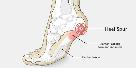 Hapad Heel Pads