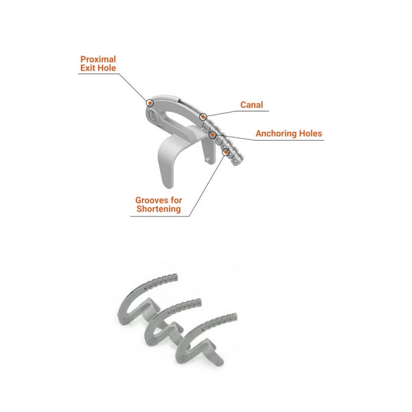 Load image into Gallery viewer, North Coast Medical Isoforce Outrigger System
