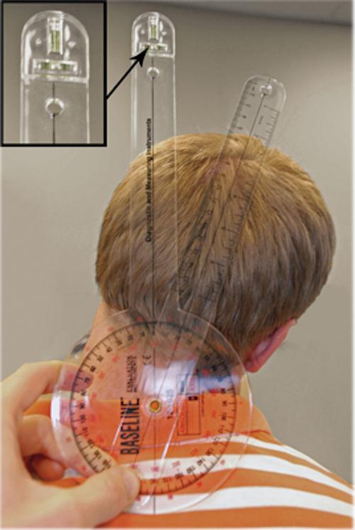 Baseline Absolute+Axis Goniometers