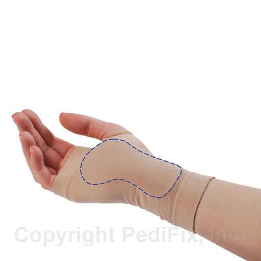 Load image into Gallery viewer, PediFix® Visco-GEL® Carpal Tunnel Relief Sleeve
