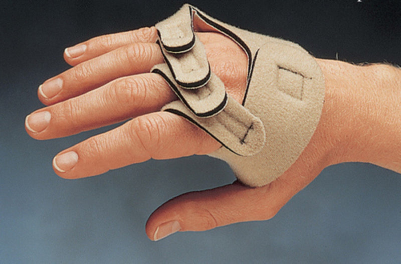 Load image into Gallery viewer, Norco Soft MP Ulnar Drift Support
