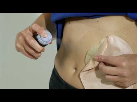 Load and play video in Gallery viewer, Trio Ostomy Care Elite Sting Free Adhesive Remover
